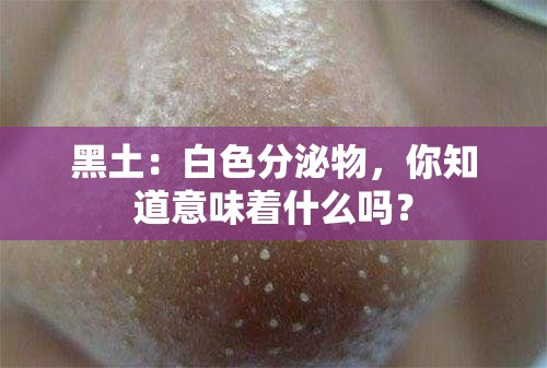 黑土：白色分泌物，你知道意味着什么吗？