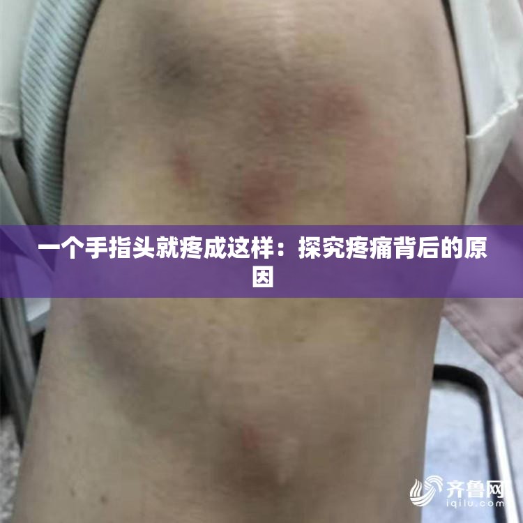 一个手指头就疼成这样：探究疼痛背后的原因