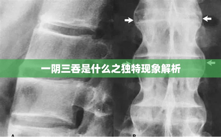 一阴三吞是什么之独特现象解析